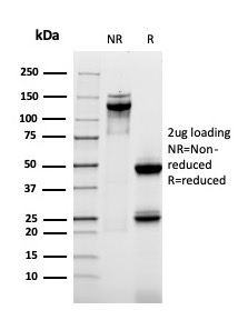 SDS-PAGE Analysis of Purified MUC-1 Recombinant Mouse Monoclonal Antibody (rMUC1/955). Confirmation of Purity and Integrity of Antibody.