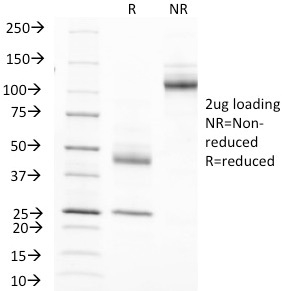 SDS-PAGE Analysis Purified MUC-1 Mouse Monoclonal Antibody (MUC1/845). Confirmation of Integrity and Purity of Antibody.