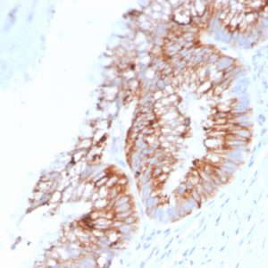 Formalin-fixed, paraffin-embedded human colon stained with MUC2 Mouse Monoclonal Antibody (SPM513).