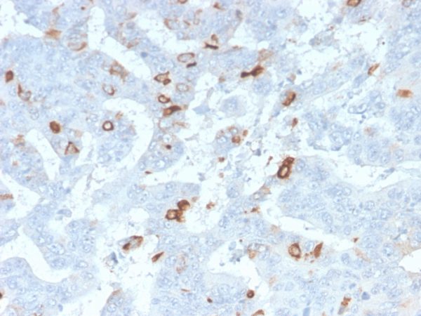Formalin-fixed, paraffin-embedded human colon stained with MUC2 Rabbit Recombinant Monoclonal Antibody (MLP/2970R).