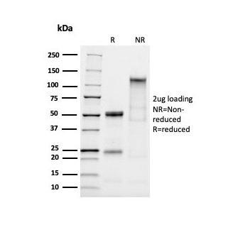 SDS-PAGE Analysis Purified MUC2 Rabbit Recombinant Monoclonal Antibody (MLP/2970R). Confirmation of Purity and Integrity of Antibody.