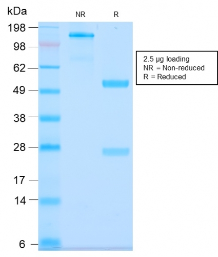 SDS-PAGE Analysis of Purified MUC3 Rabbit Recombinant Monoclonal Antibody (MUC3/2992R). Confirmation of Purity and Integrity of Antibody.