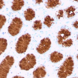 Formalin-fixed, paraffin-embedded human colon stained with MUC5AC Recombinant Mouse Monoclonal Antibody (rMUC5AC/3779).