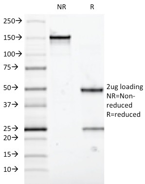 SDS-PAGE Analysis of Purified MUC5AC Mouse Monoclonal Antibody (58M1). Confirmation of Integrity and Purity of Antibody.