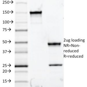SDS-PAGE Analysis of Purified MUC5AC Mouse Monoclonal Antibody (ZAP70/2047). Confirmation of Integrity and Purity of Antibody.