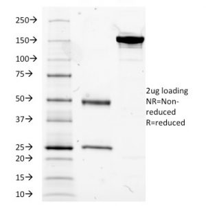 SDS-PAGE Analysis of Purified MUC5AC Mouse Monoclonal Antibody (2-11M1). Confirmation of Purity and Integrity of Antibody.