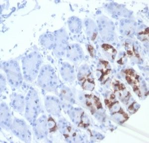 Formalin-fixed, paraffin-embedded human stomach stained with MUC6 Recombinant Rabbit Monoclonal Antibody (MUC6/7069R). HIER: Tris/EDTA, pH9.0, 45min. 2 °: HRP-polymer, 30min. DAB, 5min.