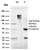 SDS-PAGE Analysis of Purified MXI1 Mouse Monoclonal Antibody (PCRP-MXI1-1A3). Confirmation of Purity and Integrity of Antibody.