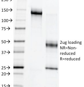 SDS-PAGE Analysis Purified c-Myb Mouse Monoclonal Antibody (MYB286).
