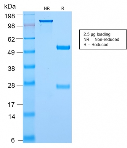 SDS-PAGE Analysis Purified c-Myc Rabbit Recombinant Monoclonal Antibody (MYC2895R). Confirmation of Purity and Integrity of Antibody.