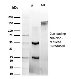 SDS-PAGE Analysis of Purified L-Myc / MYCL Mouse Monoclonal Antibody (PCRP-MYCL-2D5). Confirmation of Integrity and Purity of Antibody.