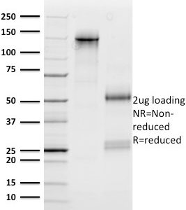 SDS-PAGE Analysis of Purified n-Myc Mouse Monoclonal Antibody (NMYC-1). Confirmation of Purity and Integrity of Antibody.
