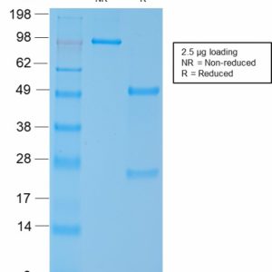 SDS-PAGE Analysis of Purified SM-MHC Recombinant Rabbit Monoclonal Antibody (MYH11/2303R). Confirmation of Integrity and Purity of the Antibody.