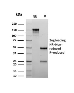 SDS-PAGE Analysis of Purified MyoD1 Recombinant Mouse Monoclonal Antibody (rMYOD1/6911). Confirmation of Purity and Integrity of Antibody.
