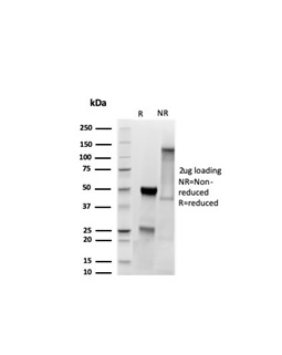 SDS-PAGE Analysis Purified MyoD1 Recombinant Rabbit Monoclonal Antibody (MYOD1/3418R). Confirmation of Purity and Integrity of Antibody.