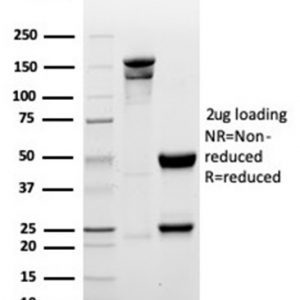 SDS-PAGE Analysis of Purified Myogenin Recombinant Rabbit Monoclonal Antibody (MYOG/6298R). Confirmation of Integrity and Purity of Antibody.