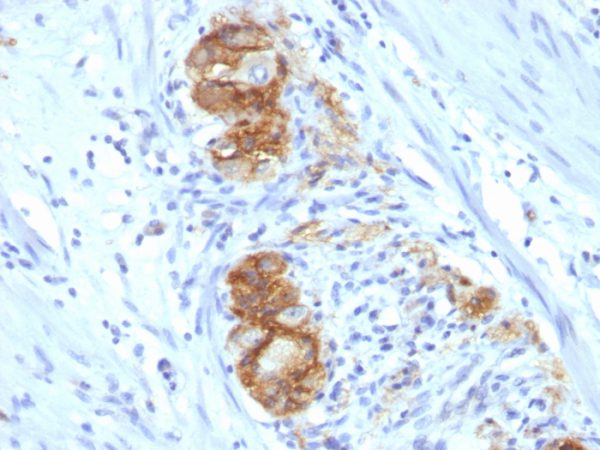 Formalin-fixed, paraffin-embedded human Colon Ganglion stained with CD56 Monoclonal Antibody (123C3.D5)