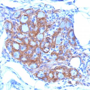 Formalin-fixed, paraffin-embedded human Pancreas stained with CD56 Monoclonal Antibody (SPM128)