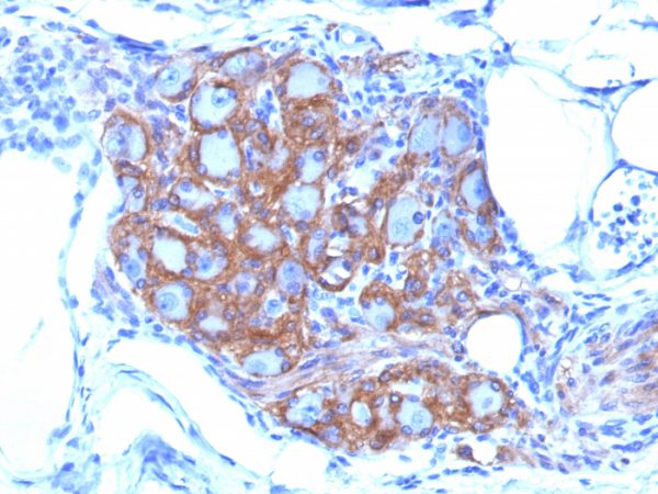 Formalin-fixed, paraffin-embedded human Pancreas stained with CD56 Monoclonal Antibody (SPM128)