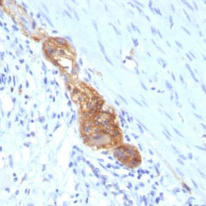 Formalin-paraffin human Colon stained with CD56 MAb (SPM489)