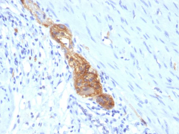 Formalin-paraffin human Colon stained with CD56 MAb (SPM489)