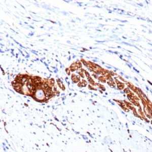 Formalin-fixed, paraffin-embedded human Colon Ganglion stained with CD56 Monoclonal Antibody (123C3.D5 + 123A8)
