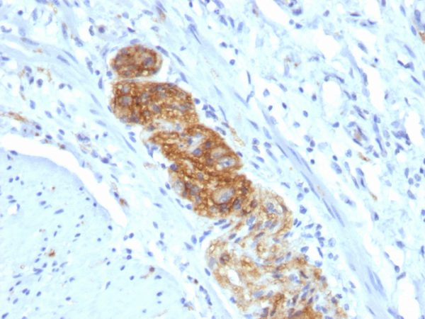 Formalin-fixed, paraffin-embedded human Colon stained with CD56 Monoclonal Antibody (NCAM1/784)