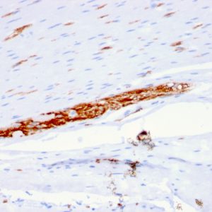 Formalin-fixed, paraffin-embedded human Colon stained with CD56 Mouse Monoclonal Antibody (ERIC-1).