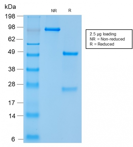 SDS-PAGE Analysis Purified CD56 Rabbit Recombinant Monoclonal Antibody (NCAM1/2217R). Confirmation of Integrity and Purity of Antibody.