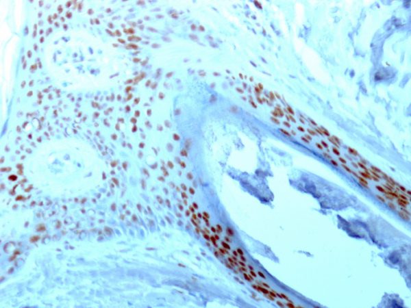 Formalin-fixed, paraffin-embedded human Skin stained with Nucleolin Monoclonal Antibody (364-5).