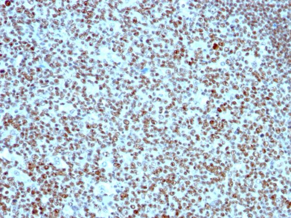 Formalin-fixed, paraffin-embedded human Tonsil stained with Nucleolin Monoclonal Antibody (364-5).