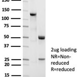 SDS-PAGE Analysis Purified Nucleolin Recombinant Rabbit Monoclonal Antibody (NCL/7014R). Confirmation of Integrity and Purity of Antibody.