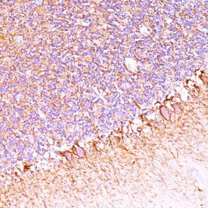 Formalin-fixed, paraffin-embedded human Cerebellum stained with Neurofilament Monoclonal Antibody (SPM563).