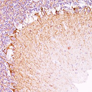 Formalin-fixed, paraffin-embedded human Cerebellum stained with Neurofilament Monoclonal Antibody (RT-97).