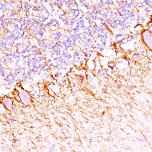 Formalin-fixed, paraffin-embedded human Cerebellum stained with Neurofilament Monoclonal Antibody (SPM203).