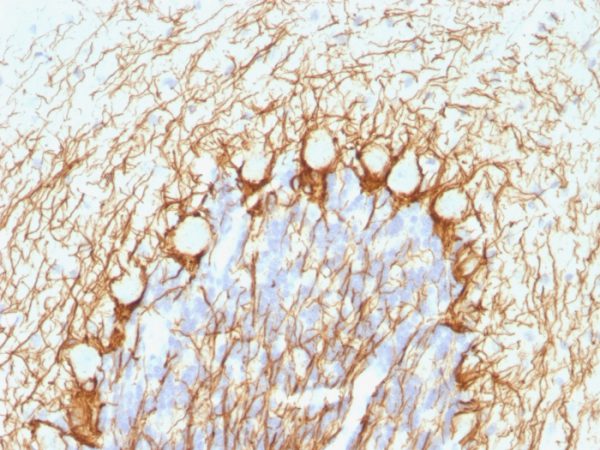 Formalin-fixed, paraffin-embedded human Cerebellum stained with Neurofilament Mouse Monoclonal Antibody (NE14).