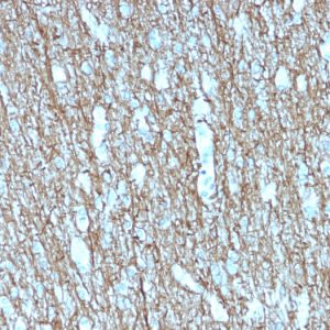 Formalin-fixed, paraffin-embedded human Brain stained with Neurofilament Mouse Recombinant Monoclonal Antibody (rNF421).
