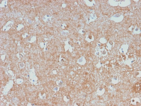 Formalin-fixed, paraffin-embedded human Cerebellum stained with Neurofilament Rabbit Monoclonal Antibody (NEFL/2983R).