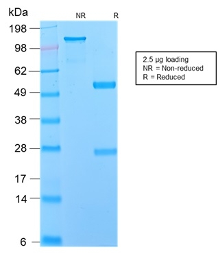 SDS-PAGE Analysis Purified NGFR Rabbit Recombinant Monoclonal Antibody (NGFR/2550R). Confirmation of Integrity and Purity of Antibody.