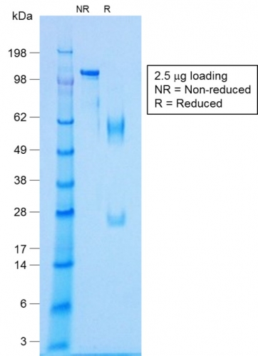 SDS-PAGE Analysis Purified NKX2.2 Rabbit Recombinant Monoclonal Antibody (NX2/1422R).