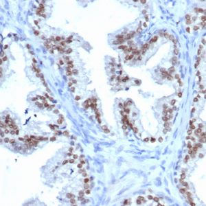 Formalin-fixed, paraffin-embedded human prostate stained with NKX3.1 Recombinant Mouse Monoclonal Antibody (rNKX3.1/6620).