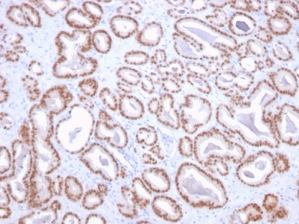 Formalin-fixed, paraffin-embedded human prostate stained with NKX3.1-Monospecific Mouse Monoclonal Antibody (NKX3.1/2836).