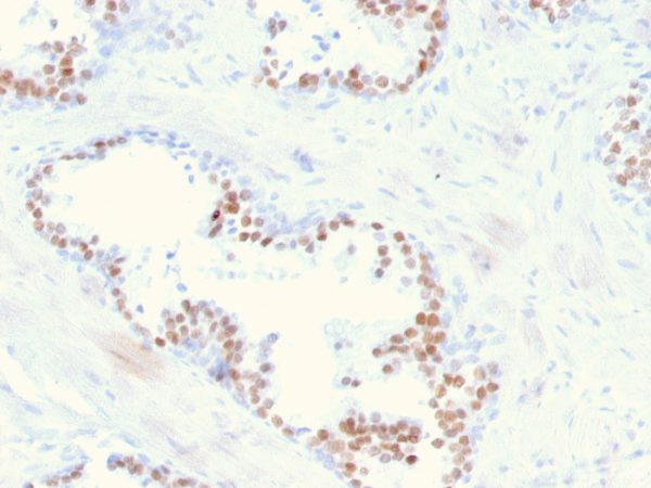 Formalin-fixed, paraffin-embedded human prostate stained with NKX3.1-Monospecific Mouse Monoclonal Antibody (NKX3.1/2836).
