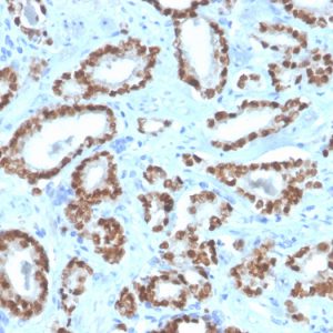 Formalin-fixed, paraffin-embedded human prostate stained with NKX3.1 Recombinant Rabbit Monoclonal Antibody (NKX3.1/4562R).