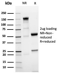 SDS-PAGE Analysis Purified NKX3.1 Recombinant Rabbit Monoclonal Antibody (NKX3.1/4562R). Confirmation of Purity and Integrity of Antibody.