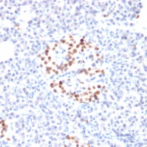 Formalin-fixed, paraffin-embedded human Pancreas stained with NKX6.1 Mouse Monoclonal Antibody (NKX61/2561).