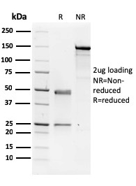 SDS-PAGE Analysis of Purified NME1 / nm23-H1 Mouse Monoclonal Antibody (CPTC-NME1-2). Confirmation of Purity and Integrity of Antibody.