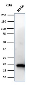 Western Blot Analysis of HeLa cell lysate using NME1 / nm23-H1 Mouse Monoclonal Antibody (CPTC-NME1-2).