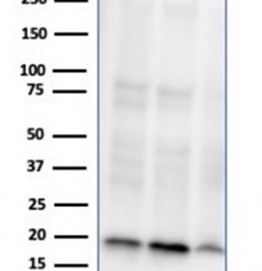 Western Blot Analysis of A549, PC3 and K562 cell lysates using NME1 / nm23-H1 Mouse Monoclonal Antibody (NME1/2737).
