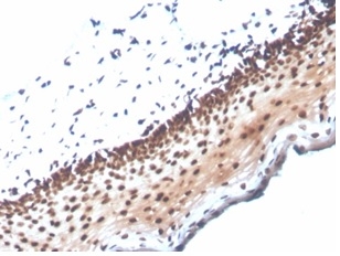 Formalin-fixed, paraffin-embedded human cervix stained with NME1 / nm23-H1 Mouse Monoclonal Antibody (NME1/2737).